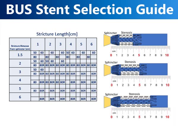 BUS Stent Selection Guide