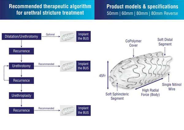 BUS TREATMERNT ALGORITHM
