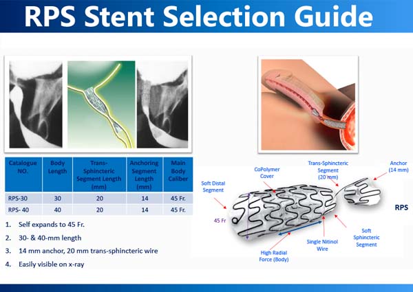 RPS Stent Selection Guide